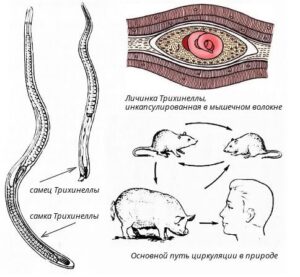 Трихинелла (Trichinella spiralis)